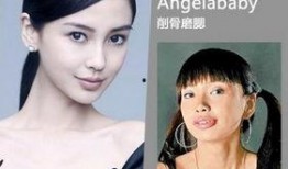 北京整容爆料案件最新,揭开医美行业潜规则与维权困境